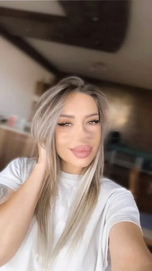 Erica