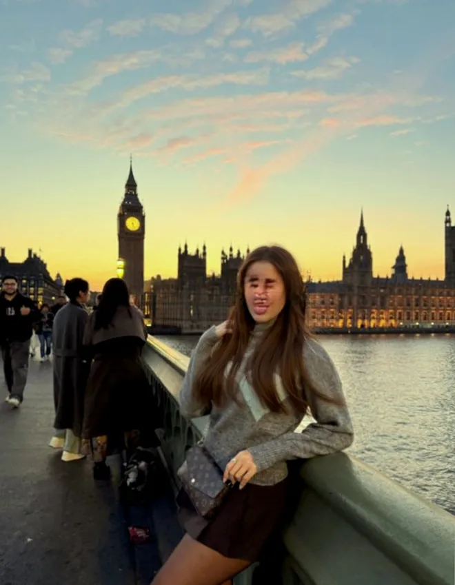 Chloe Amelie